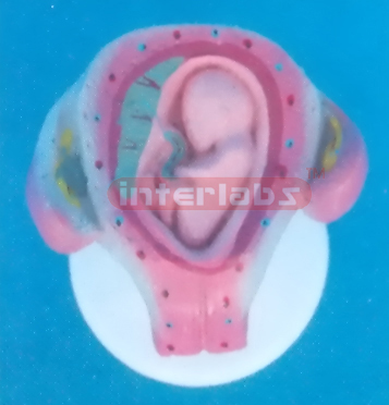 UTERUS WITH EMBRYO (3 MONTH)